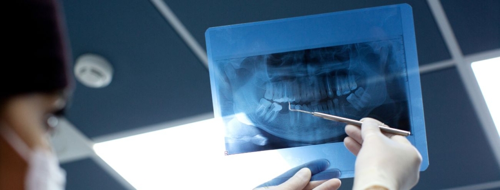Dentist checks x ray photo of mouth
