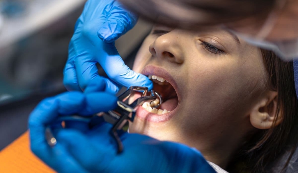 Child’s Dental Health
