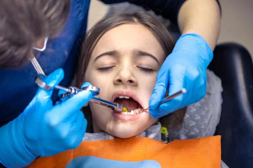 Sealants and Fluoride