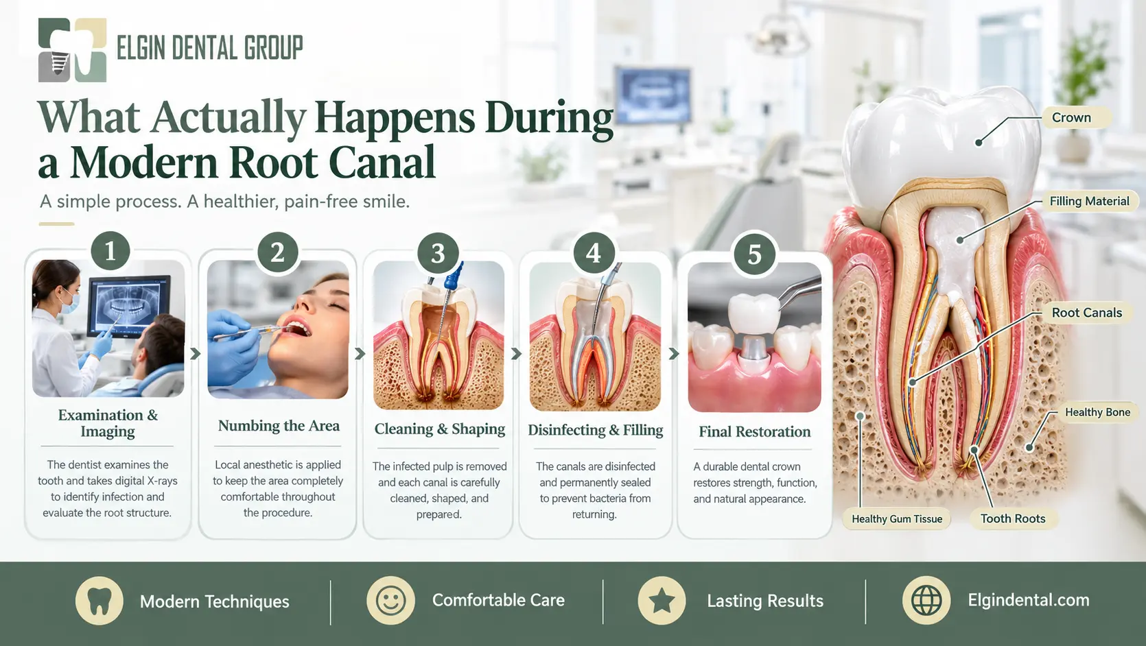Modern Root Canal
