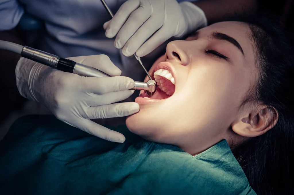 Root Canal Therapy