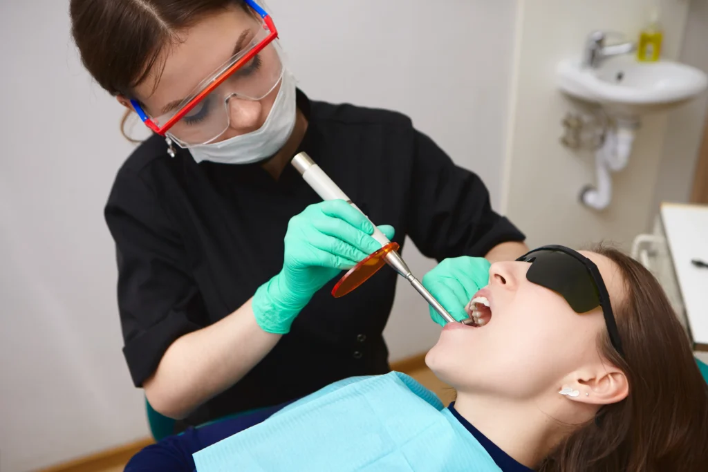 Composite Fillings